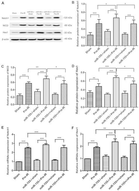 Μicrorna‑155 Induces Protection Against Cerebral Ischemiareperfusion