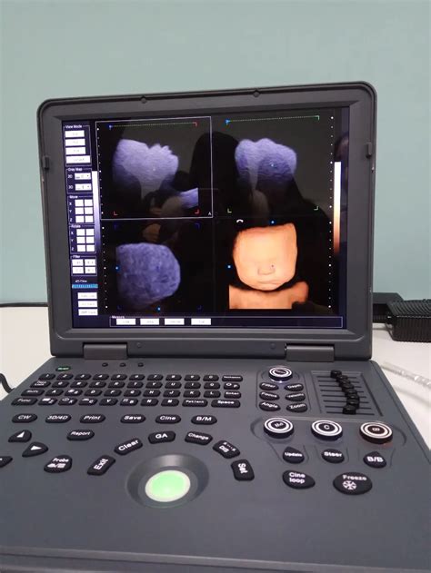 DW L3 Windows Ultrasound Dawei And 4D Color Doppler System Better Than