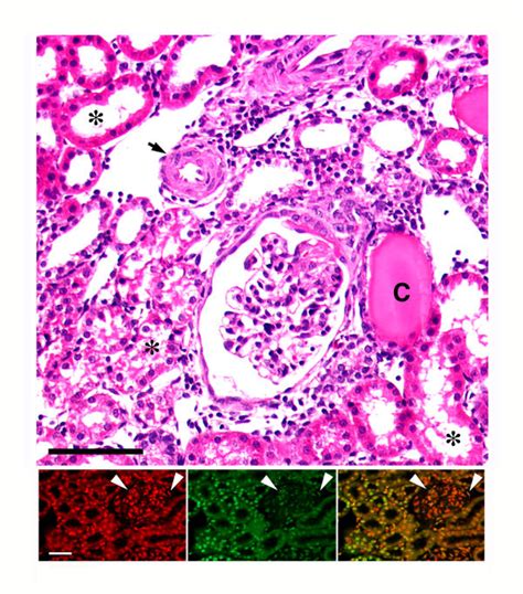 Representative Light Micrograph Top Panel Of A Kidney From An S Rat