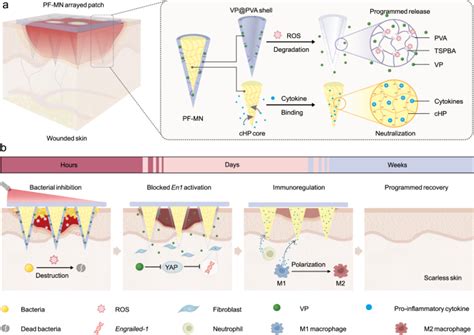 Scarless Wound Healing Programmed By Core Shell Microneedlesnature