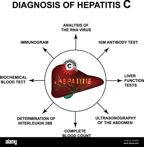 Diagnosis Of Hepatitis C World Hepatitis Day Infographics Vector