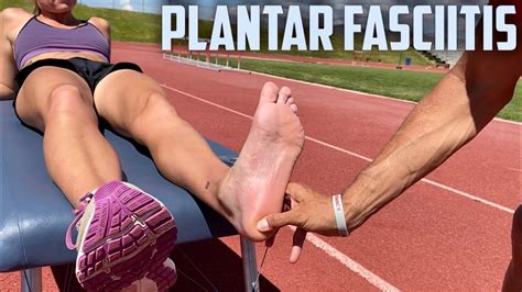 How To Fix Plantar Fasciitis [chiropractic Treatment] Youtube