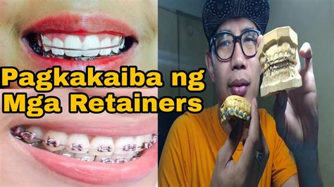 Different kinds of Retainers, Retainer like Braces with Gums, Pustiso/denture with Retainer ...