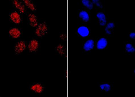 PMS2 Rabbit MAb SAB Signalway Antibody