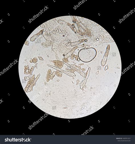 Demodex Mite Microscope View Parasite Causing Stock Photo 1658761327