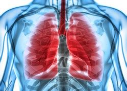 Persistence pays for asbestos pleural thickening claim - Corries ...