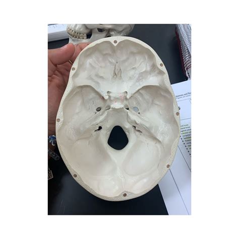 The Skull Superior View Of Cranial Floor Diagram Quizlet