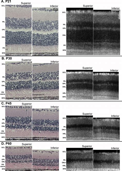 Histology And Sd Oct Comparison Representative Histology And Sd Oct