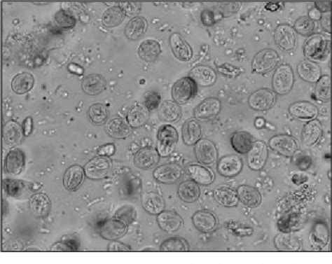 Figure 2 From Accurate Diagnosis Of Giardia Spp And Proper Fecal Examination Procedures