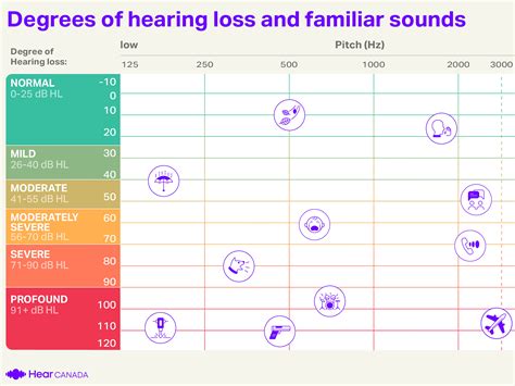 How To Read An Audiogram Essential Types And Symbols