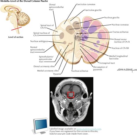 Cross Section Of Brain Stem