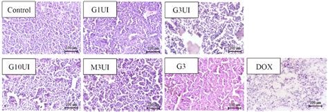 Anti Melanoma Activity Of Single Intratumoral Injection Of ZnPc