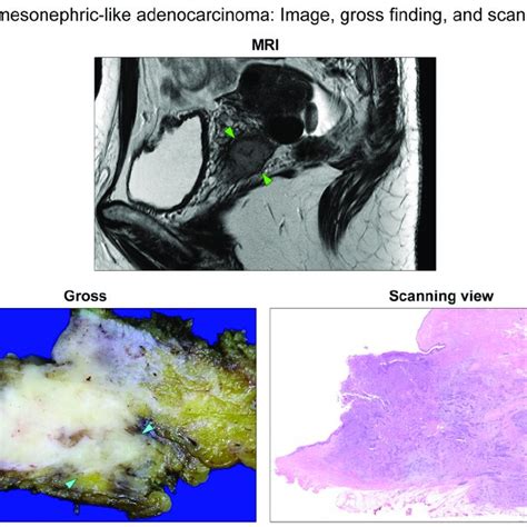 Pelvic Magnetic Resonance Imaging And Gross Finding And Scanning View Download Scientific