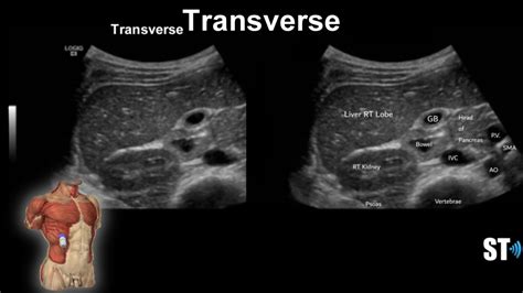 Liver Anatomy And Protocol Sonographic Tendencies