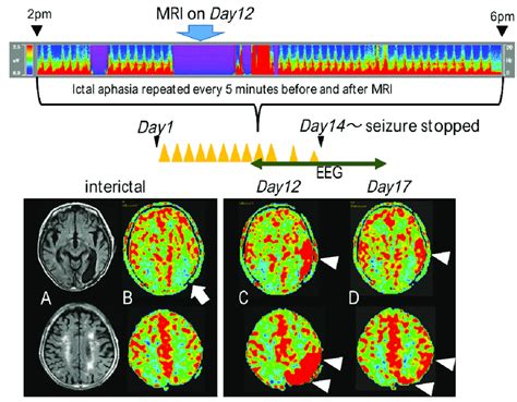 Colored Density Spectral Array Represents Hour Eeg Record From Pm To