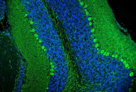 Calbindin/CALB1 Antibody A03047