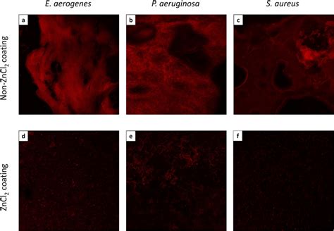 Confocal Production Of Bacterial Biofilm In Vitro As Evaluated By