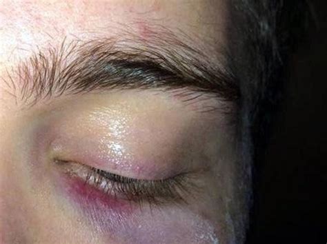 Torino Ragazzo Gay Aggredito Su Un Autobus Wdonna It