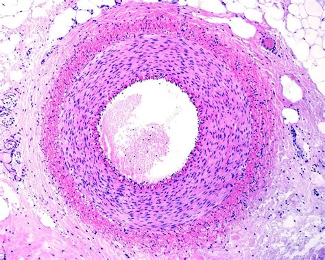 Muscular Artery Vs Elastic Artery Histology