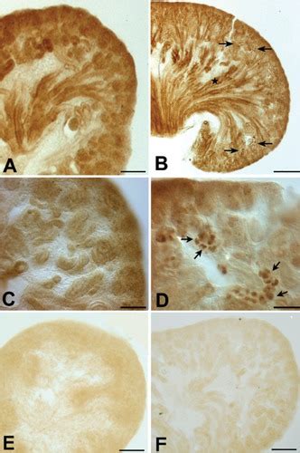 Light Micrographs Of 50 μm Thick Vibratome Sections From 16 Day Old A