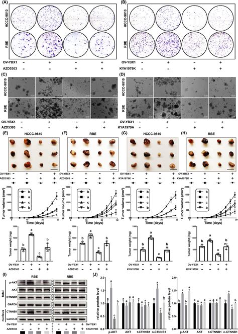 YBX1 Promotes Stemness And Cisplatin Insensitivity In Intrahepatic