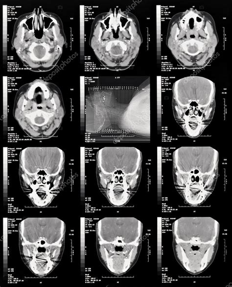 Head Cat Scan — Stock Photo © Lawcain 67907365