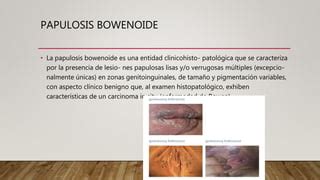 Patologia De Vagina Y Vulva Ppt