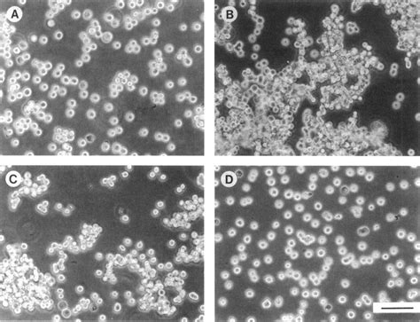 Aggregation Of The Parental Cell Line And Its Transfectants Cells Were