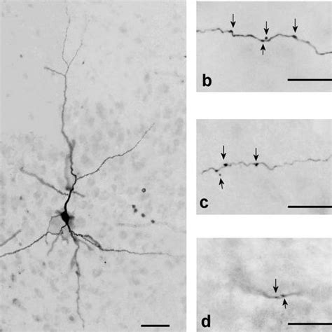 Photomicrographs Of Coronal Sections Of The Piriform Cortex Of The