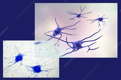 Nerve Cells Computer Illustration And Micrograph Stock Image F