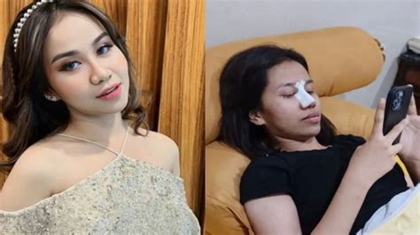 Adik Vanessa Angel Oplas Hidung Mayang Penampilan Nomor Satu