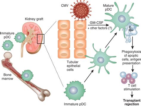 Plasmacytoid Dendritic Cells Important Players In Human Kidney