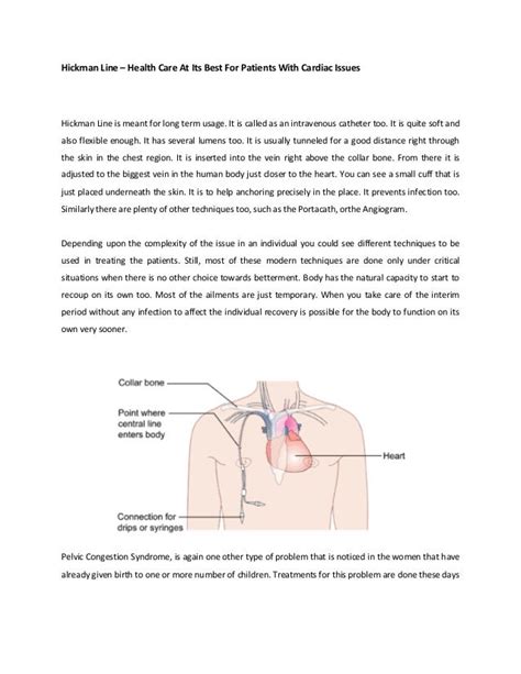 Hickman line – health care at its best for patients with cardiac issu…