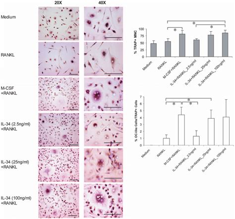 In Vitro Differentiation Of Human Osteoclasts By Il And Rankl Cd