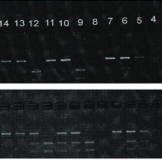 Gel Electrophoresis For TLR 9 Gene Polymorphism For Single Nucleotide