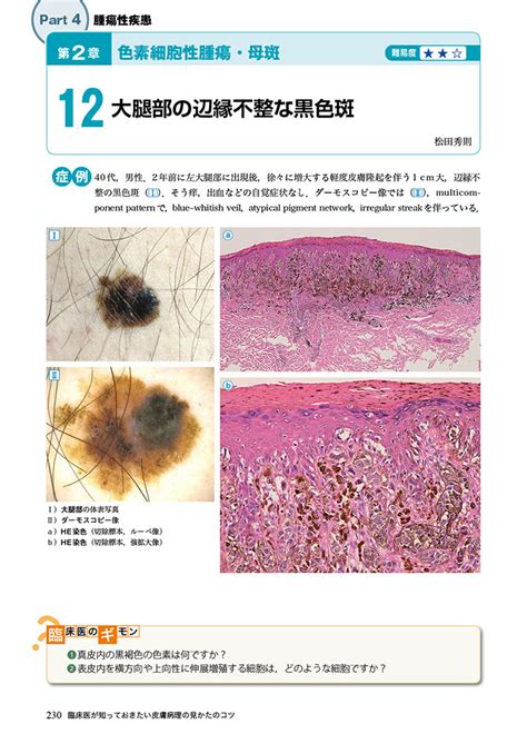 病理像＋臨床写真で一目でわかる！ 臨床医が知っておきたい皮膚病理の見かたのコツ 羊土社