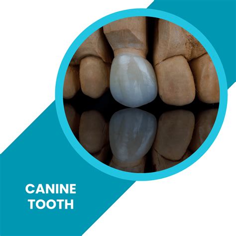 Canine Tooth - FAQ About Canine Teeth and Braces