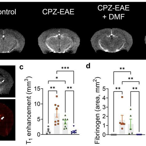 T1 Contrast Enhancement Mri Detects Response To Fty720 Treatment But