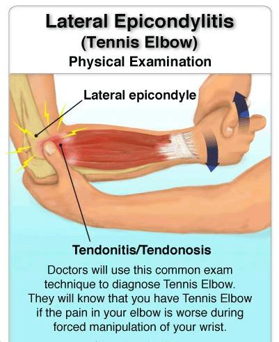 Elbow Pain Causes Treatment And When To See A Healthcare 48 OFF