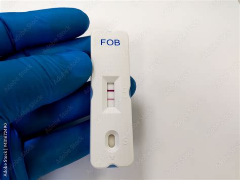 Fecal Occult Blood Test Fobt Positive By Using Rapid Test Cassette