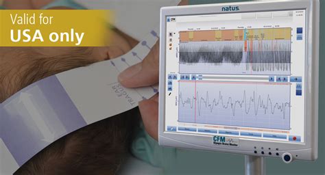 Aeeg Olympic Brainz Monitor Obm On Demand Training Usa