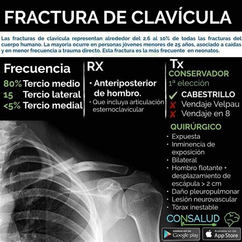 Consalud Enarm En Instagram Flashcards Consalud Fractura De