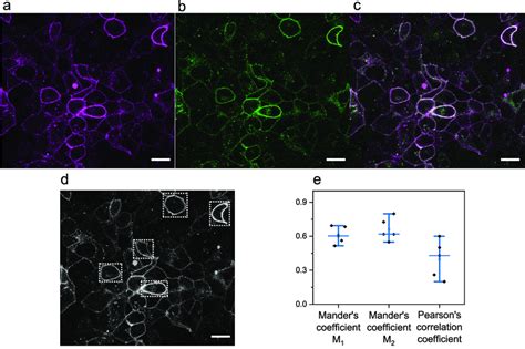 2 Expression And Colocalisation Of β 2 ­ar A186tco­il3­egfp A Cy5