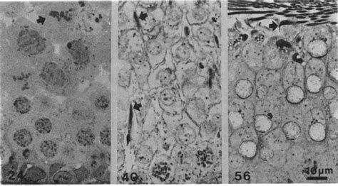 Light Micrographs From Rat Testes Of Ages Indicated At Day Meiotic