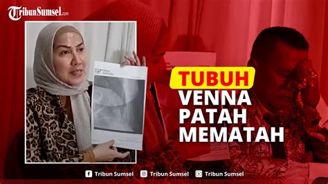 Tulang Venna Dipatahkan Ferry Pakai Trik Bela Diri Kini Ferry Irawan