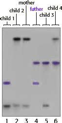 Molecular Diagnostics Exam Flashcards Quizlet