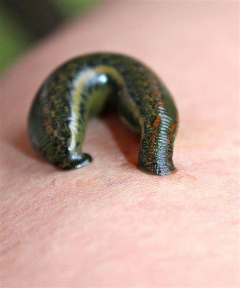 HD wallpaper: green leech on person's skin, leech therapy, medicinal ...