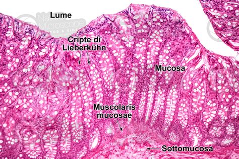 Uomo Intestino Crasso Sezione Trasversale X Intestino Crasso