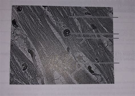 Lab Practical Cardiac Muscle Diagram Quizlet