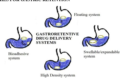 Figure 1 From ADVANCES IN GASTRORETENTIVE DRUG DELIVERY SYSTEM A